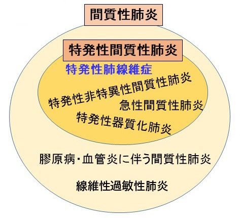 間質性肺炎 | 複十字病院 公式サイト（東京都 清瀬市）